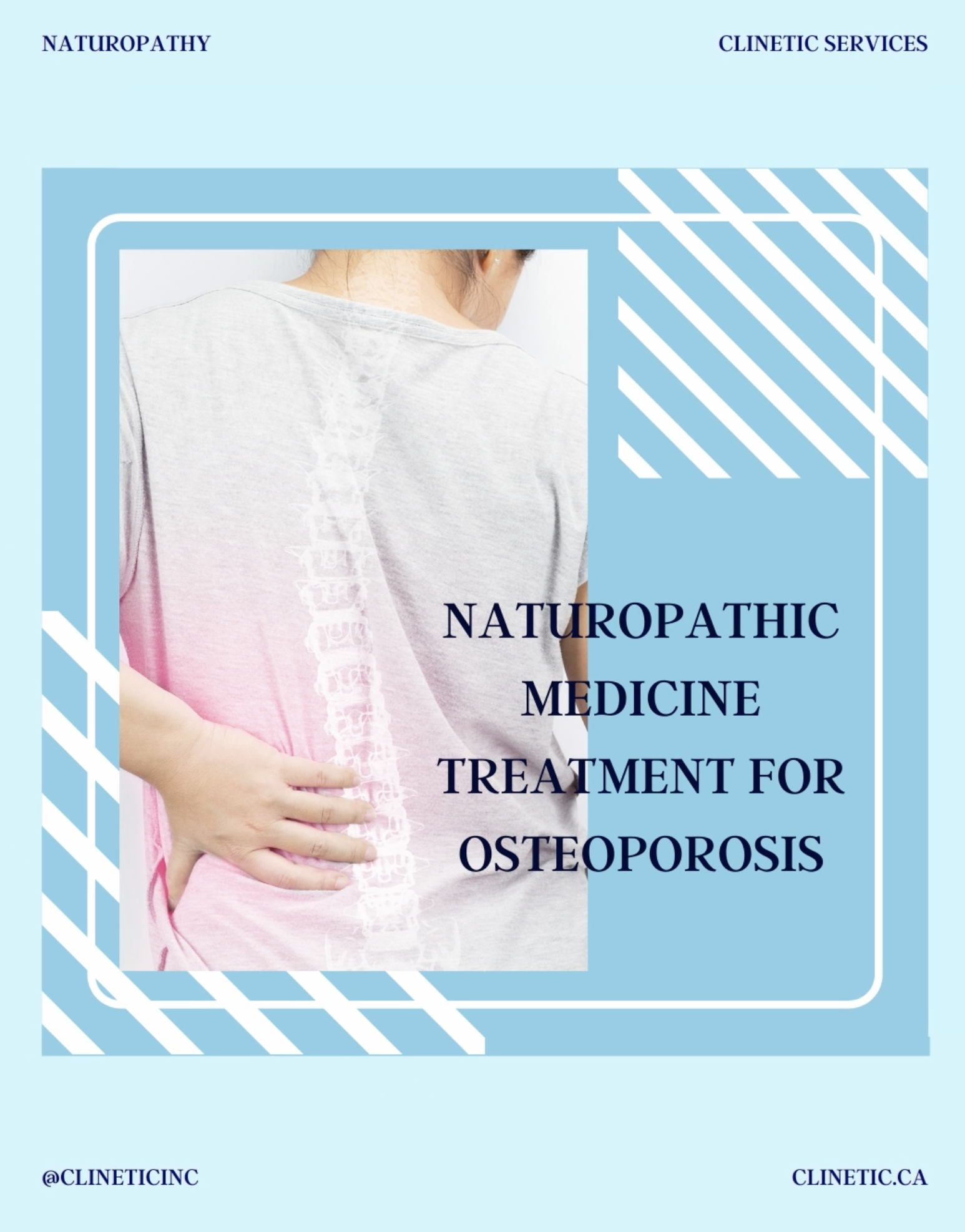 Naturopathic medicine treatment for Osteoporosis